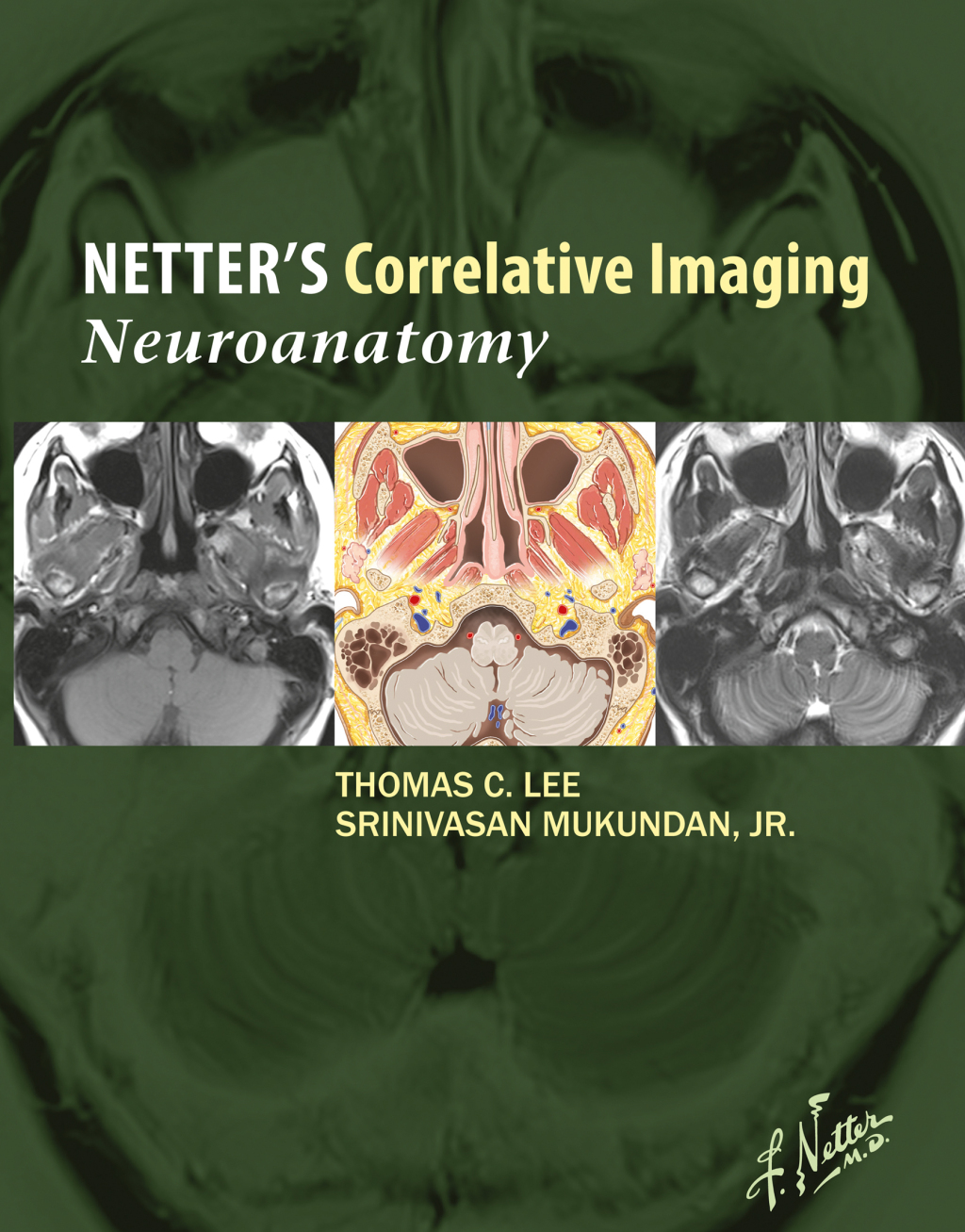 Netterâ€™s Correlative Imaging: Neuroanatomy with NetterReference.com Access  â€“ PDF/EPUB Version Downloadable