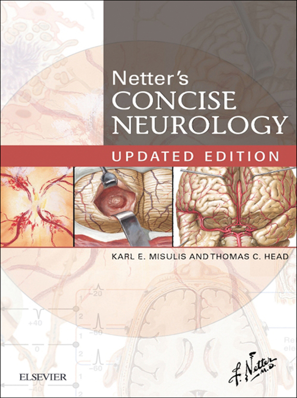 Netter's Concise Neurology Updated Edition  â€“ PDF/EPUB Version Downloadable
