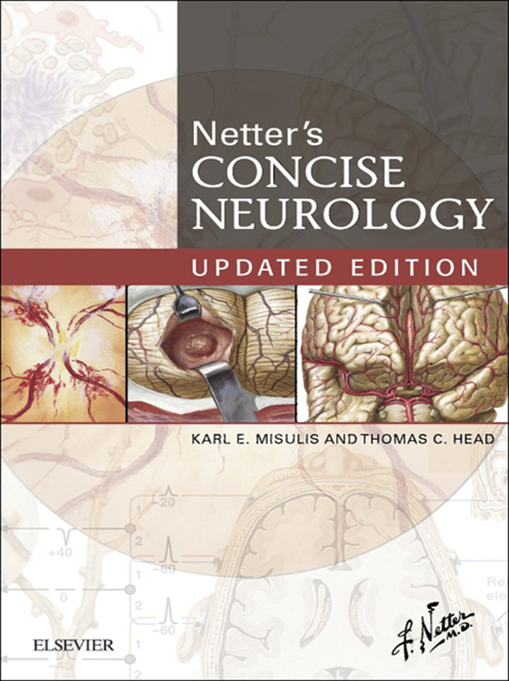 Netter's Concise Neurology Updated Edition 1st Edition â€“ PDF/EPUB Version Downloadable