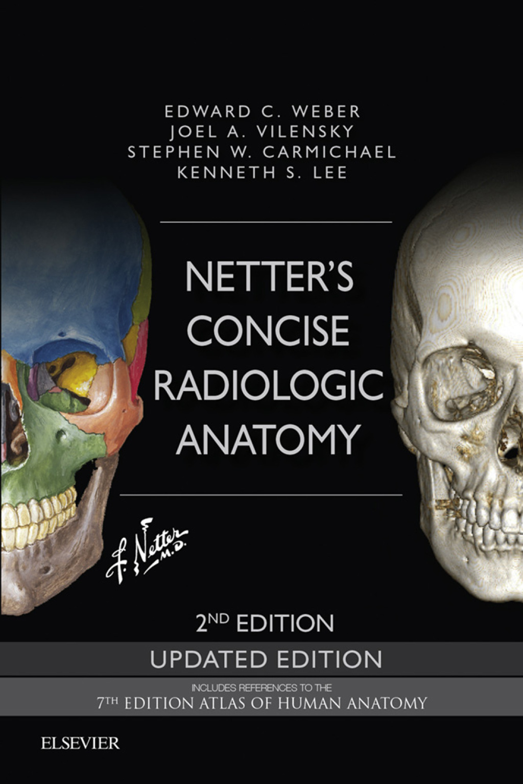 Netter's Concise Radiologic Anatomy Updated Edition 2nd Edition â€“ PDF/EPUB Version Downloadable