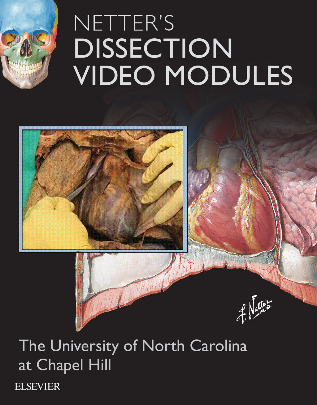 Netter's Dissection Video Modules Companion to Atlas of Human Anatomy  â€“ PDF/EPUB Version Downloadable