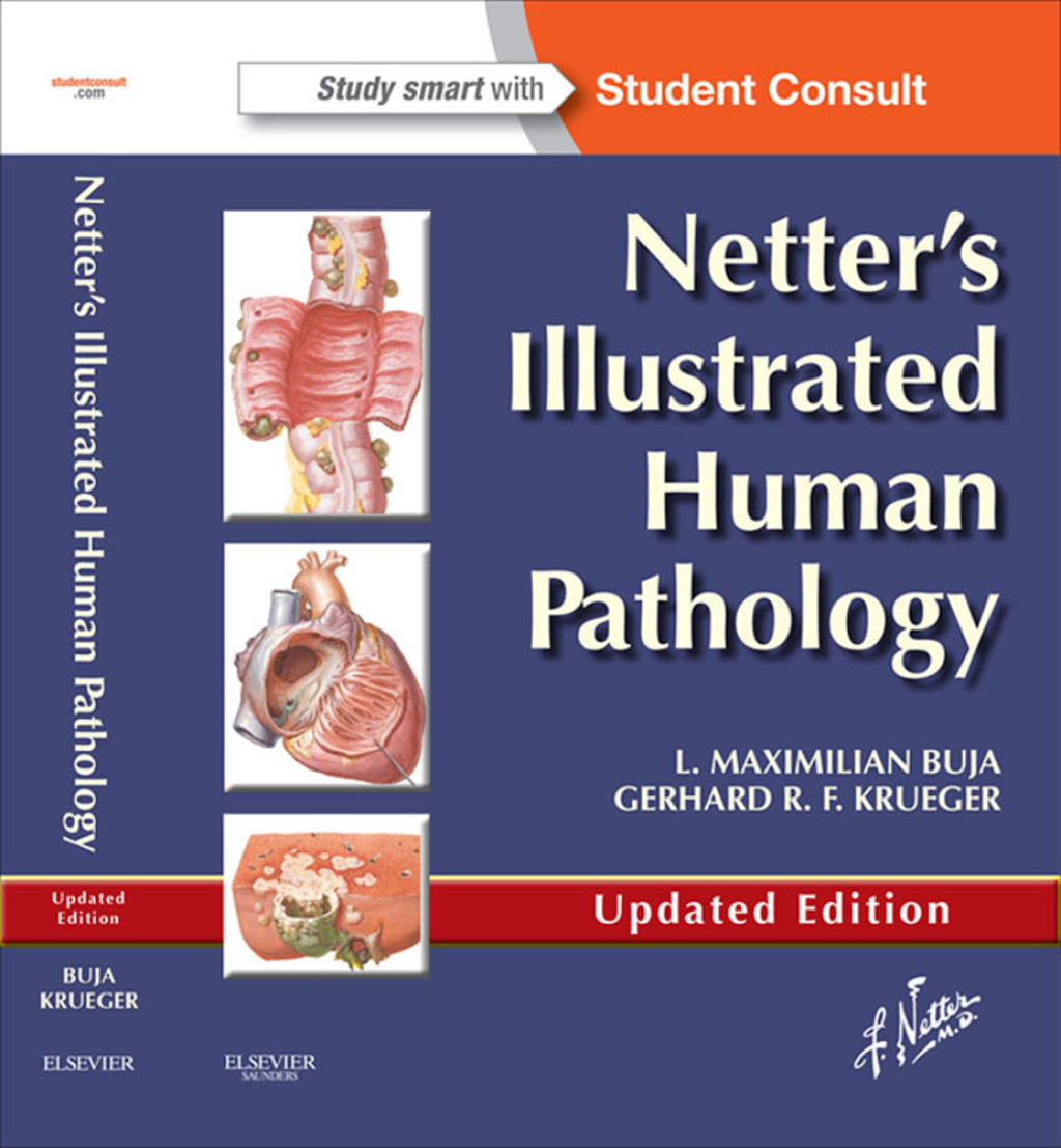 Netter's Illustrated Human Pathology Updated Edition E-book  â€“ PDF/EPUB Version Downloadable