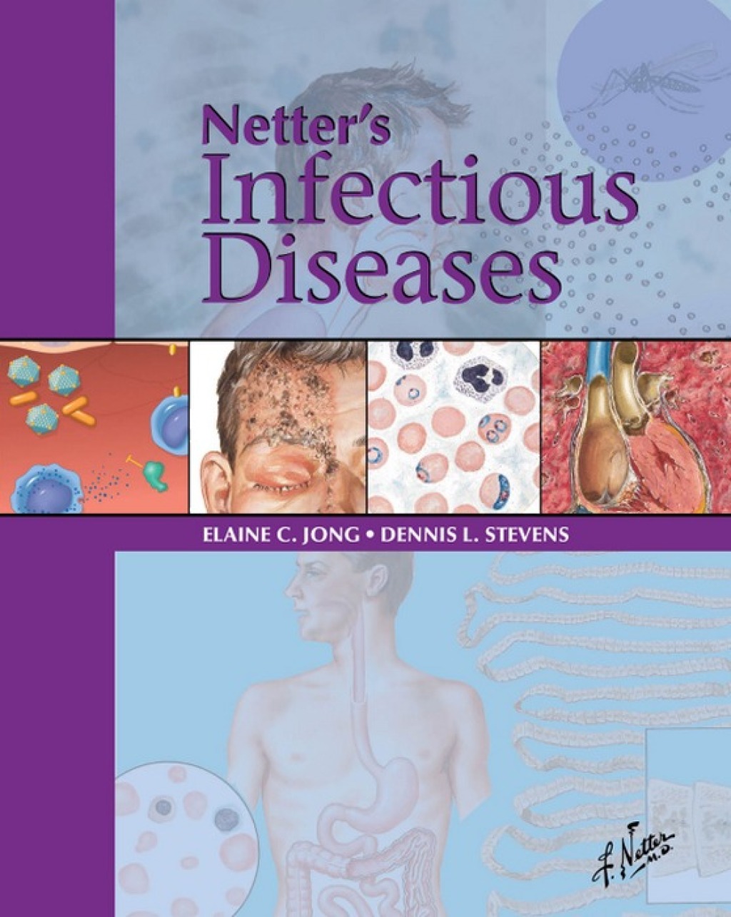 Netter's Infectious Diseases  â€“ PDF/EPUB Version Downloadable