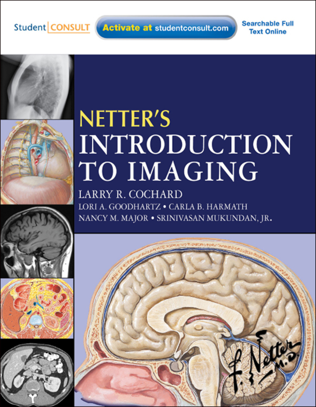 Netter's Introduction to Imaging  â€“ PDF/EPUB Version Downloadable