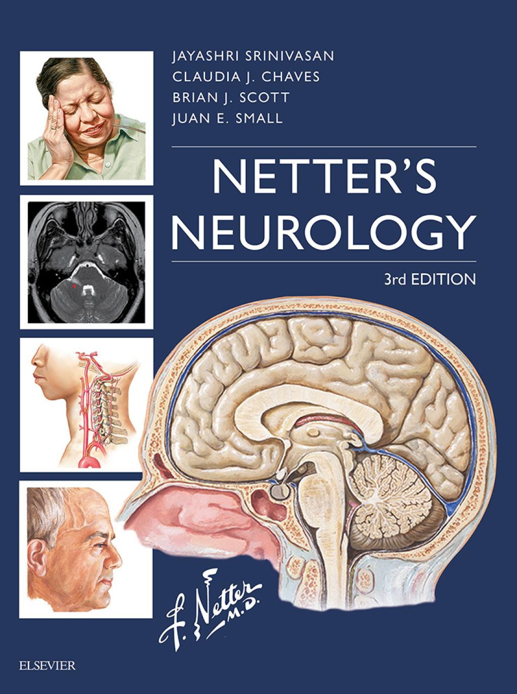 Netter's Neurology 3rd Edition â€“ PDF/EPUB Version Downloadable