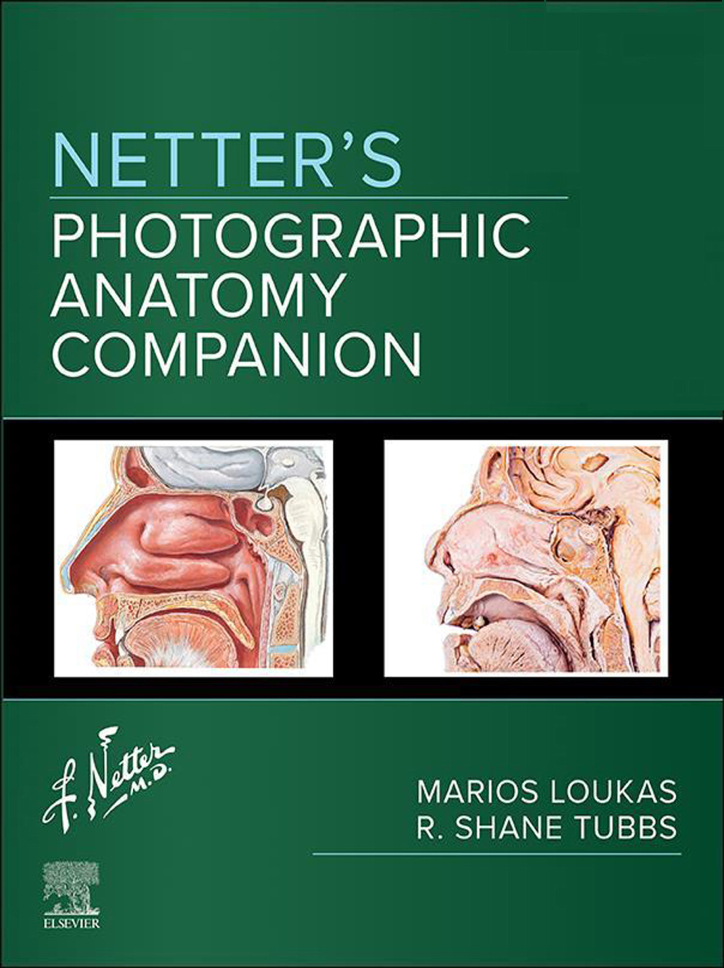 Netter's Photographic Anatomy Companion 1st Edition â€“ PDF/EPUB Version Downloadable