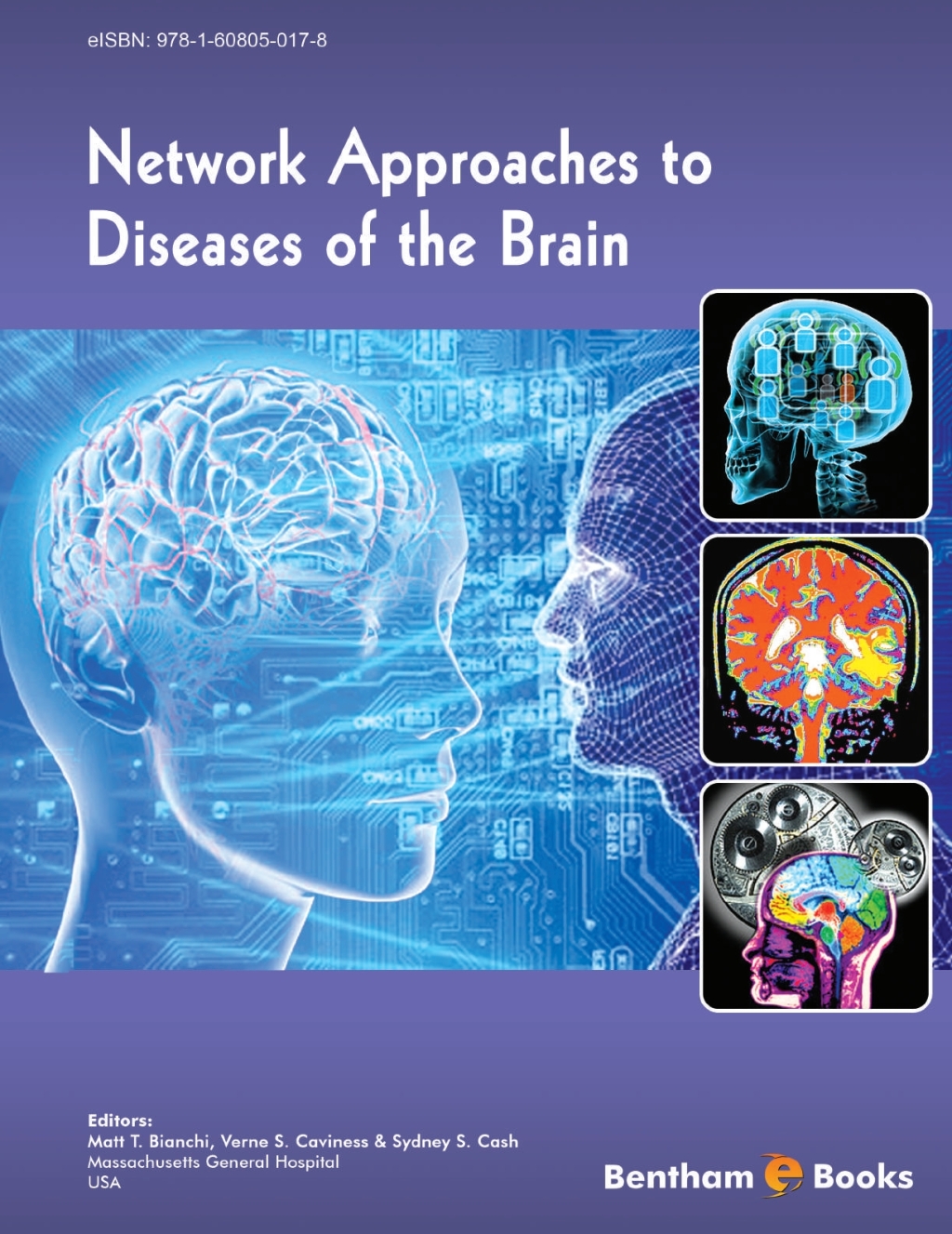 Network Approaches to Diseases of the Brain 1st Edition â€“ PDF/EPUB Version Downloadable