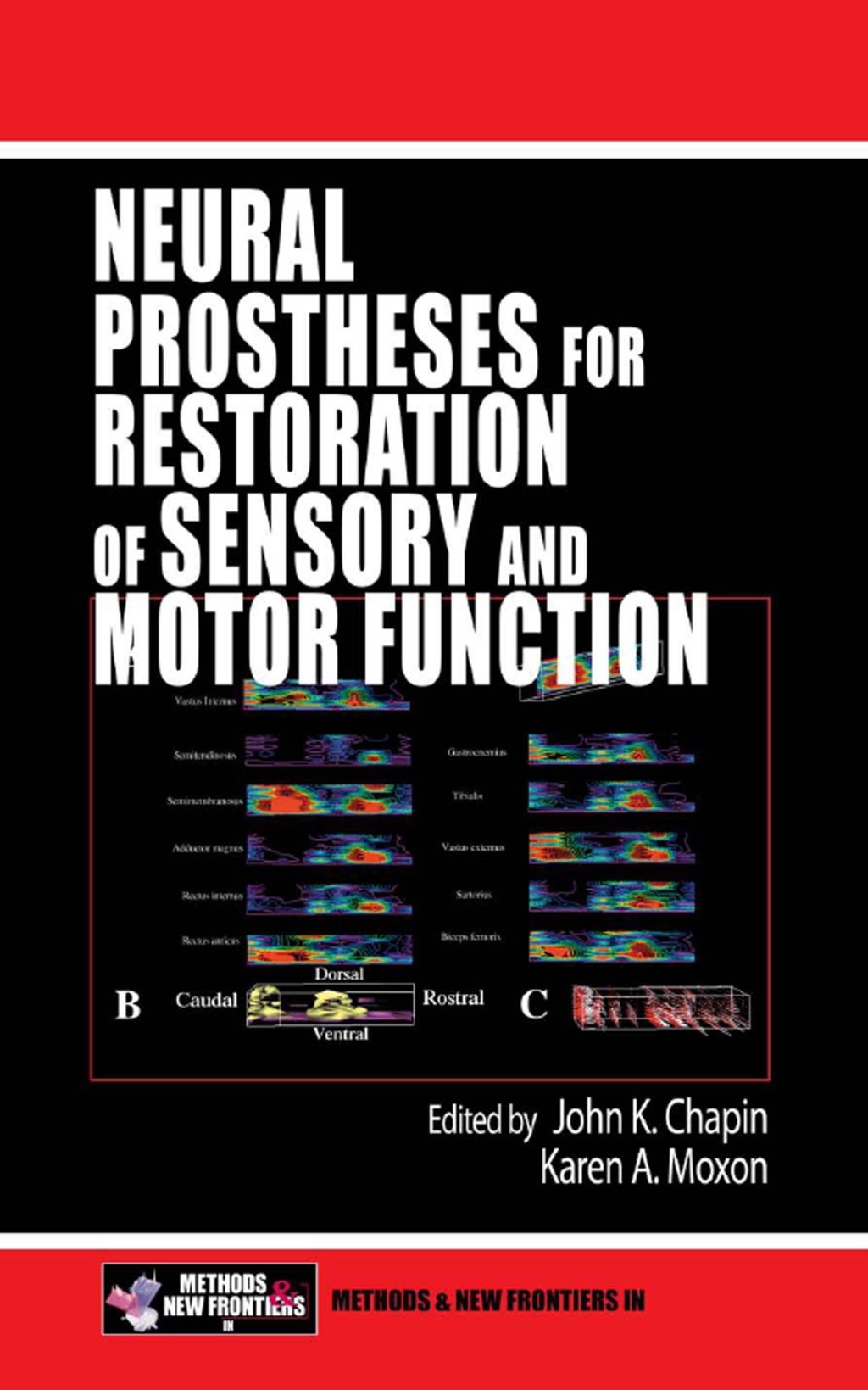 Neural Prostheses for Restoration of Sensory and Motor Function 1st Edition â€“ PDF/EPUB Version Downloadable