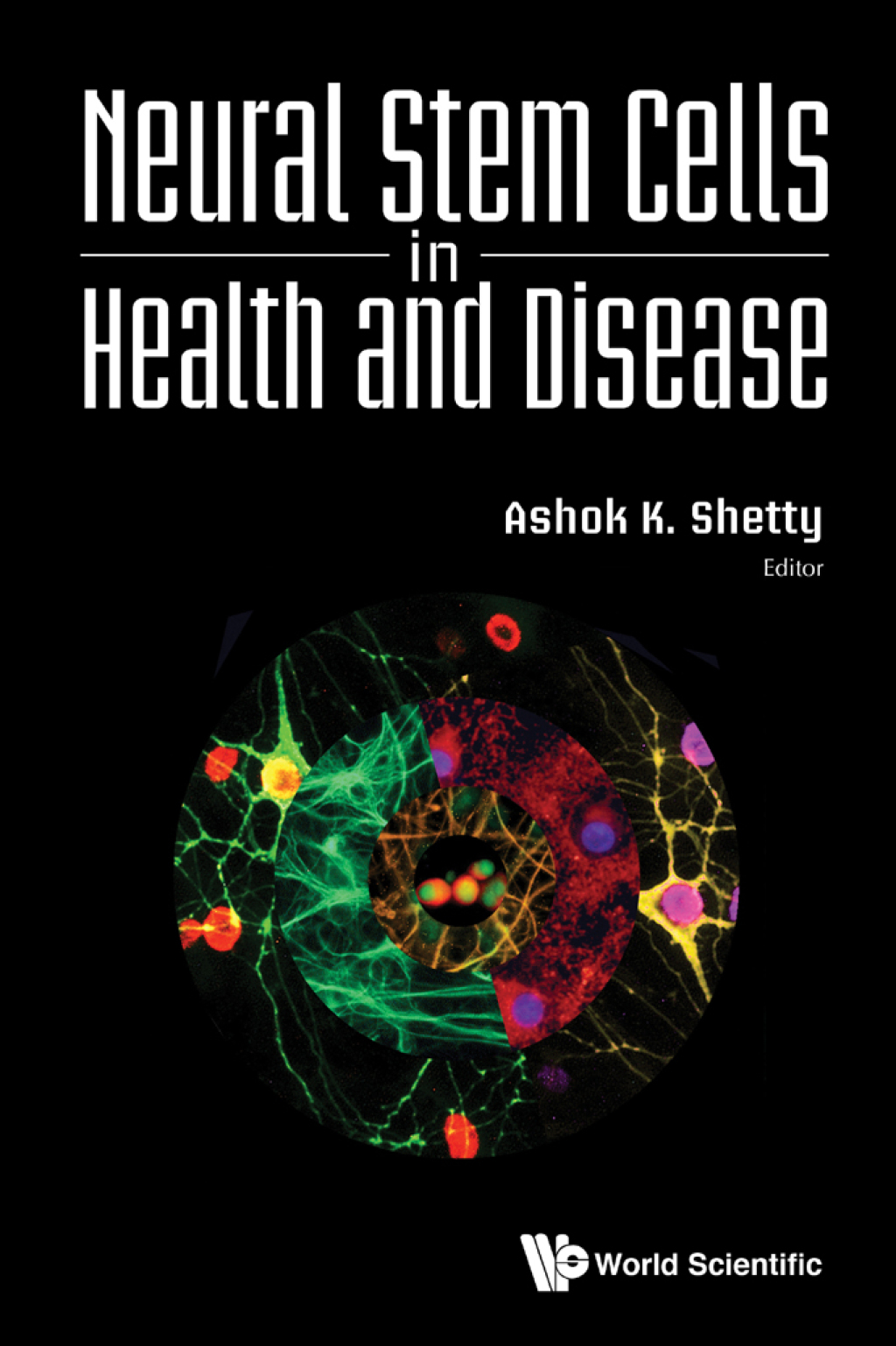 Neural Stem Cells in Health and Disease  â€“ PDF/EPUB Version Downloadable