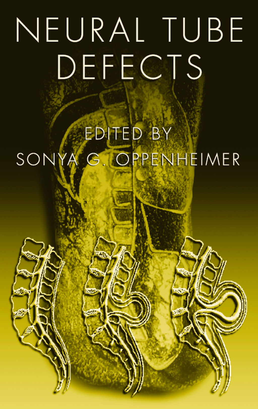 Neural Tube Defects 1st Edition â€“ PDF/EPUB Version Downloadable