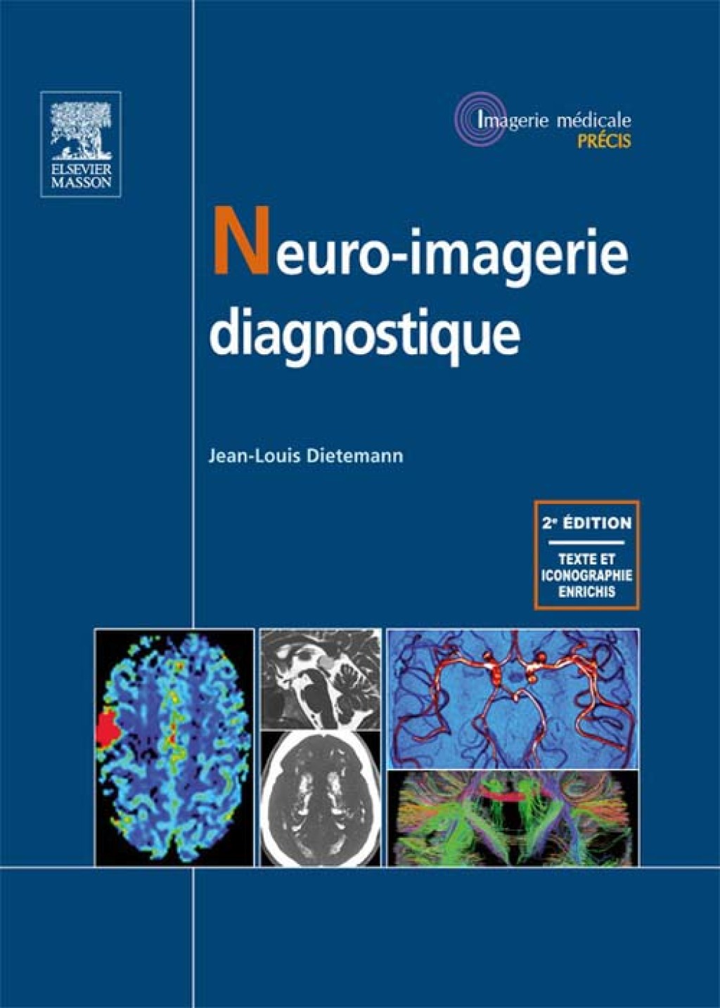 Neuro-imagerie diagnostique 2nd Edition â€“ PDF/EPUB Version Downloadable