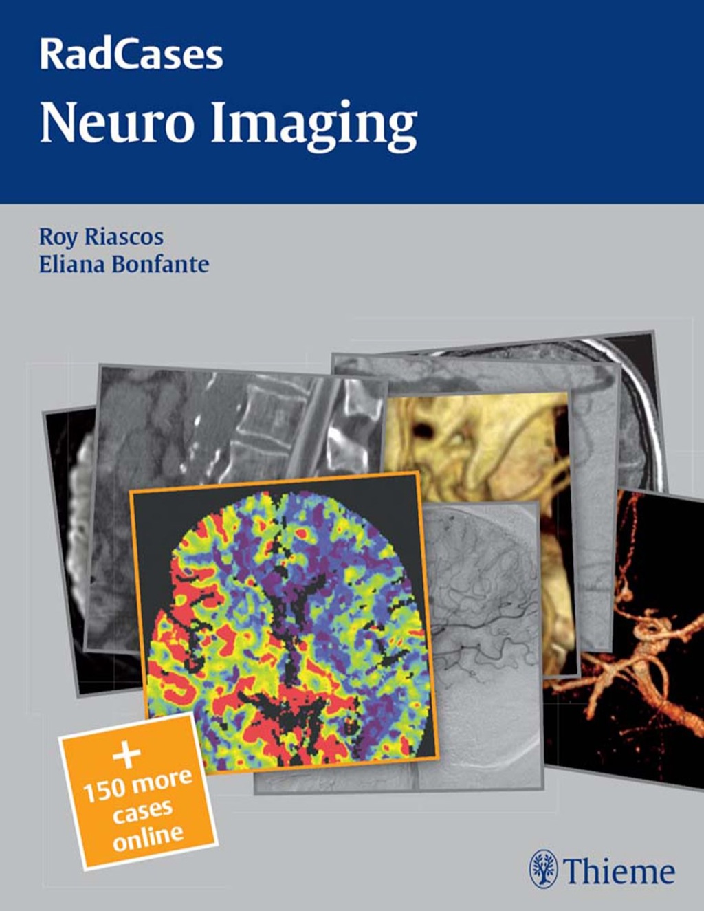 Neuro Imaging 1st Edition â€“ PDF/EPUB Version Downloadable