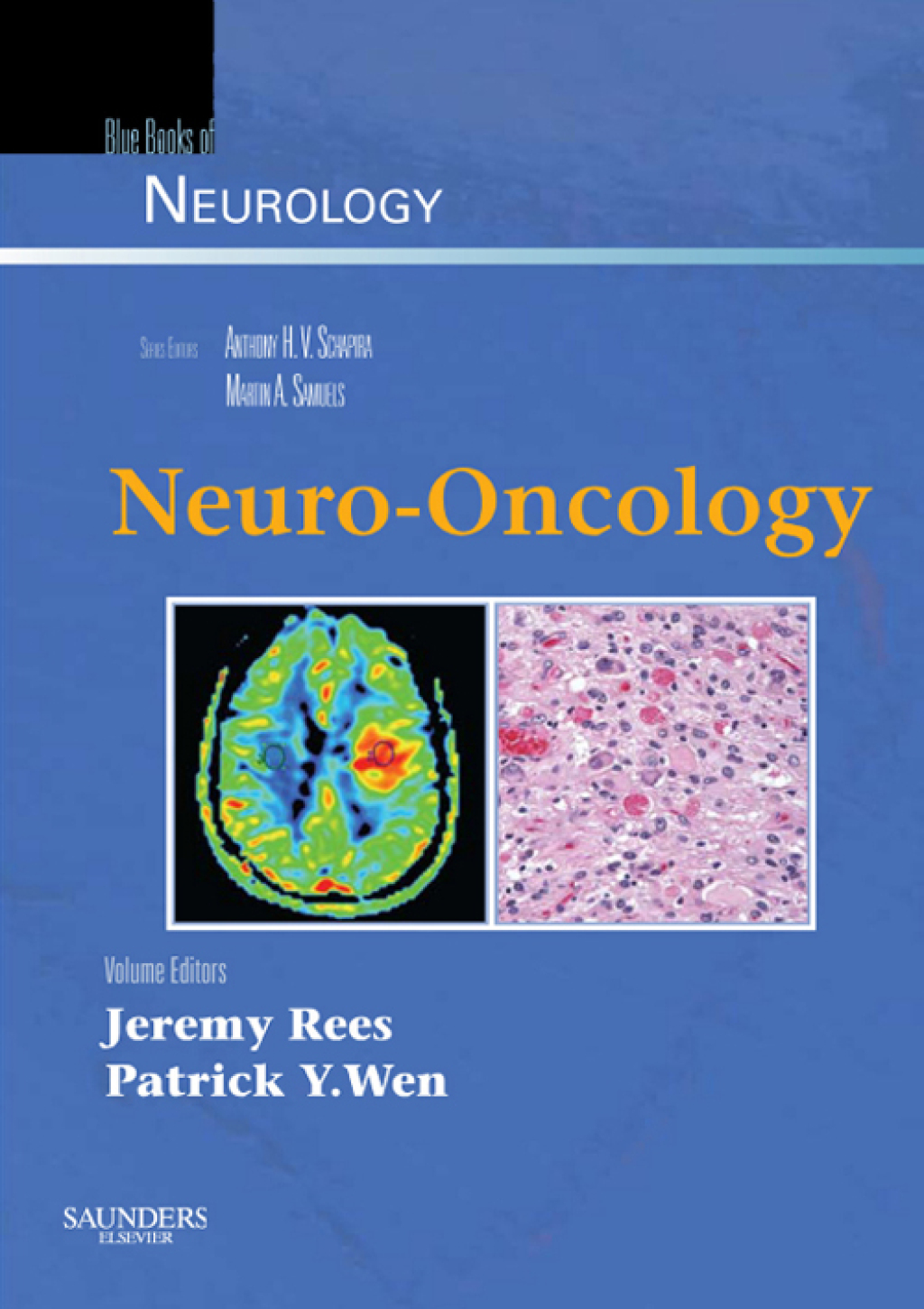 Neuro-Oncology Blue Books of Neurology Series  â€“ PDF/EPUB Version Downloadable