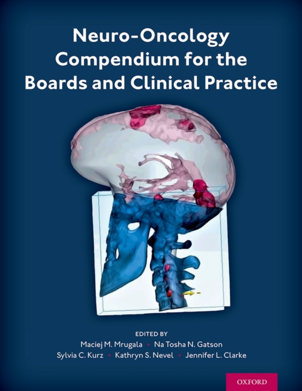 Neuro-Oncology Compendium for the Boards and Clinical Practice  â€“ PDF/EPUB Version Downloadable
