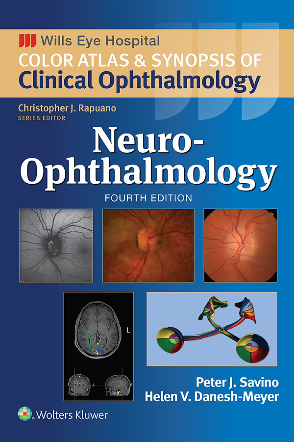 Neuro-Ophthalmology eBook with Multimedia 4th Edition â€“ PDF/EPUB Version Downloadable