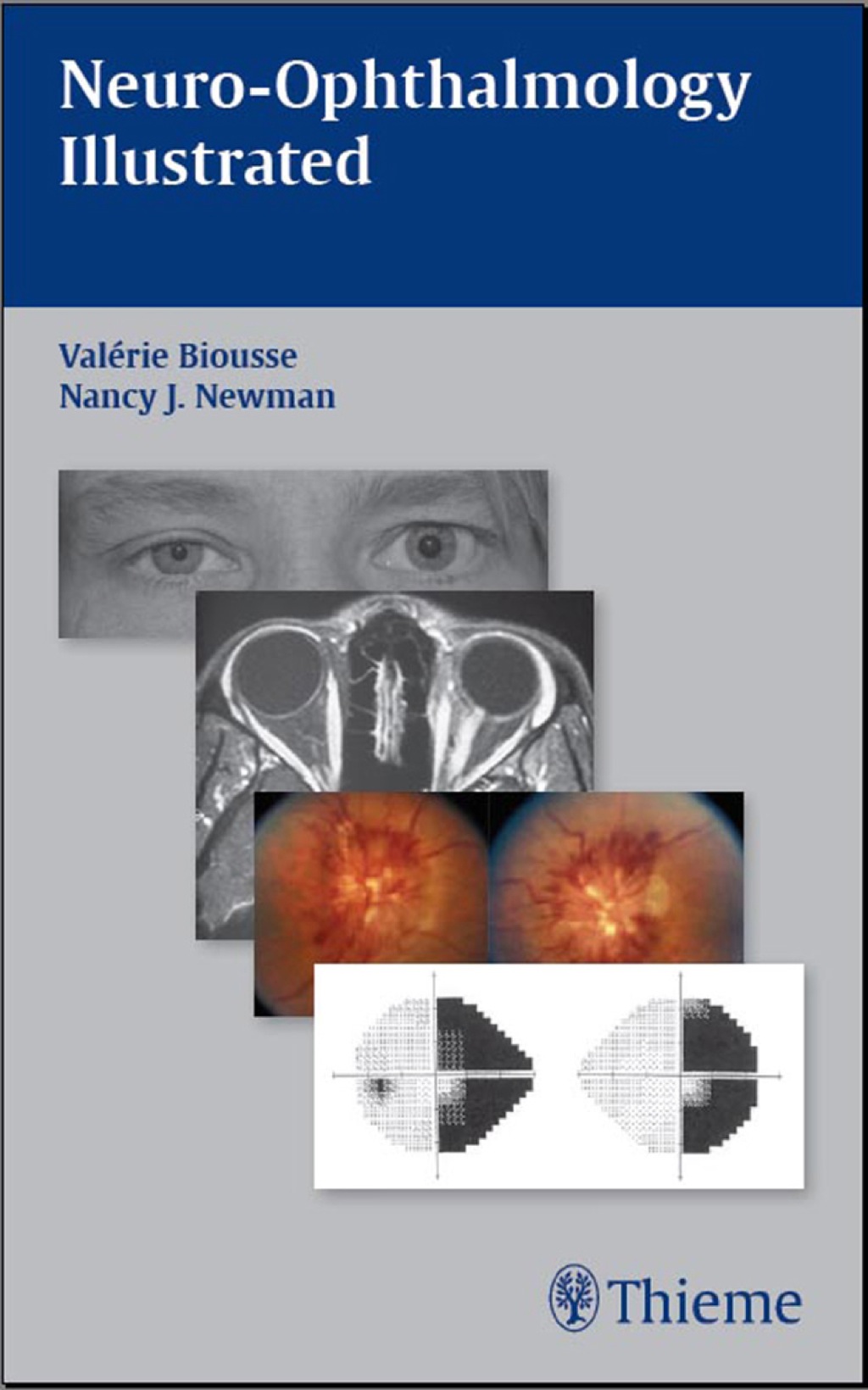 Neuro-Ophthalmology Illustrated 1st Edition â€“ PDF/EPUB Version Downloadable