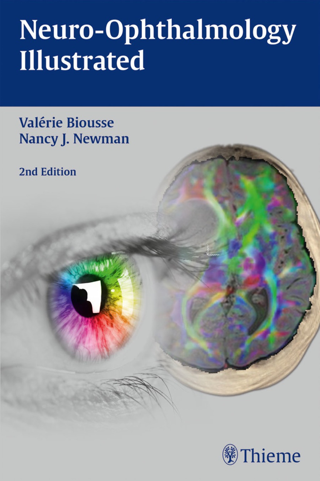 Neuro-Ophthalmology Illustrated 2nd Edition â€“ PDF/EPUB Version Downloadable