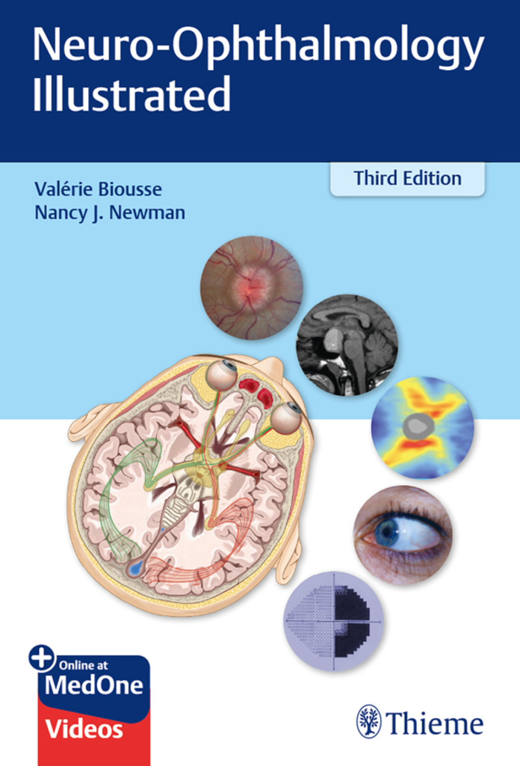Neuro-Ophthalmology Illustrated 3rd Edition â€“ PDF/EPUB Version Downloadable
