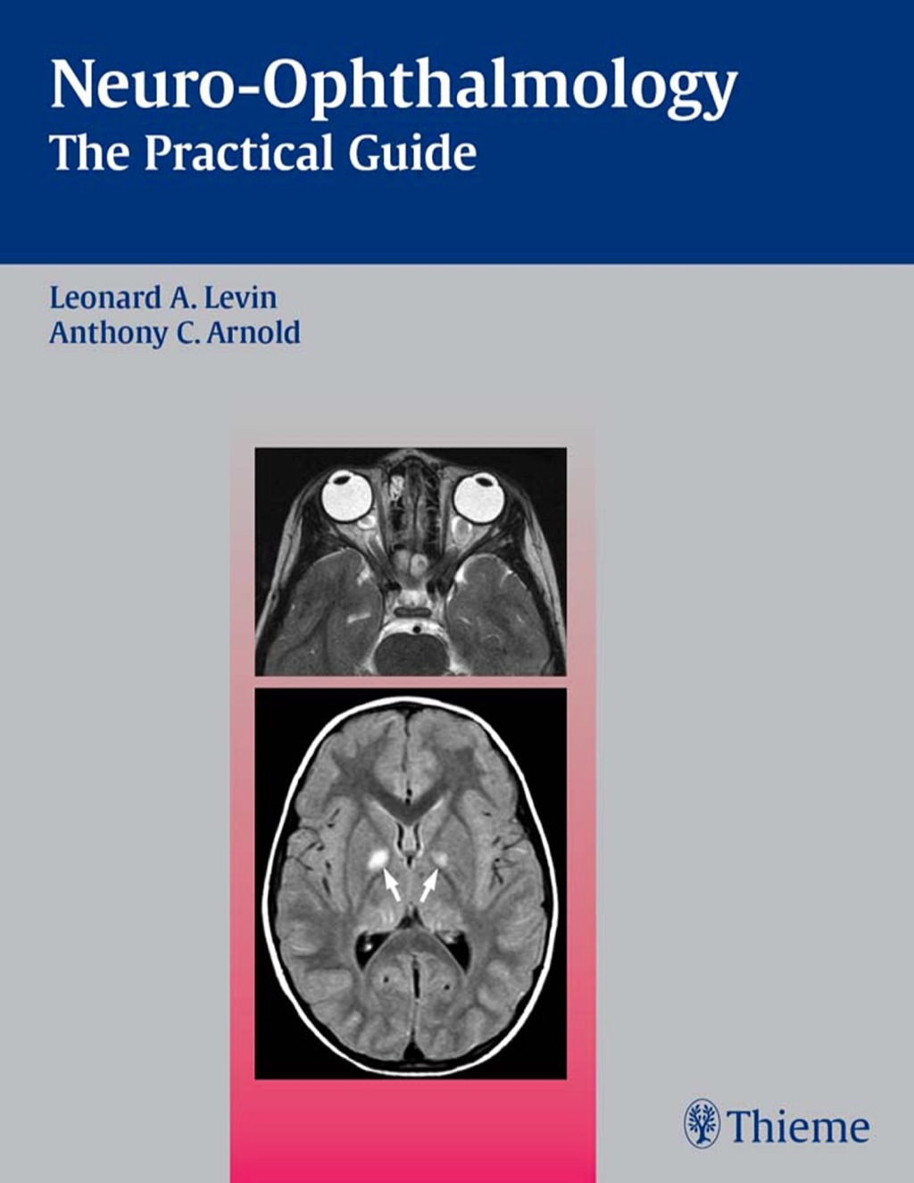 Neuro-Ophthalmology The Practical Guide 1st Edition â€“ PDF/EPUB Version Downloadable