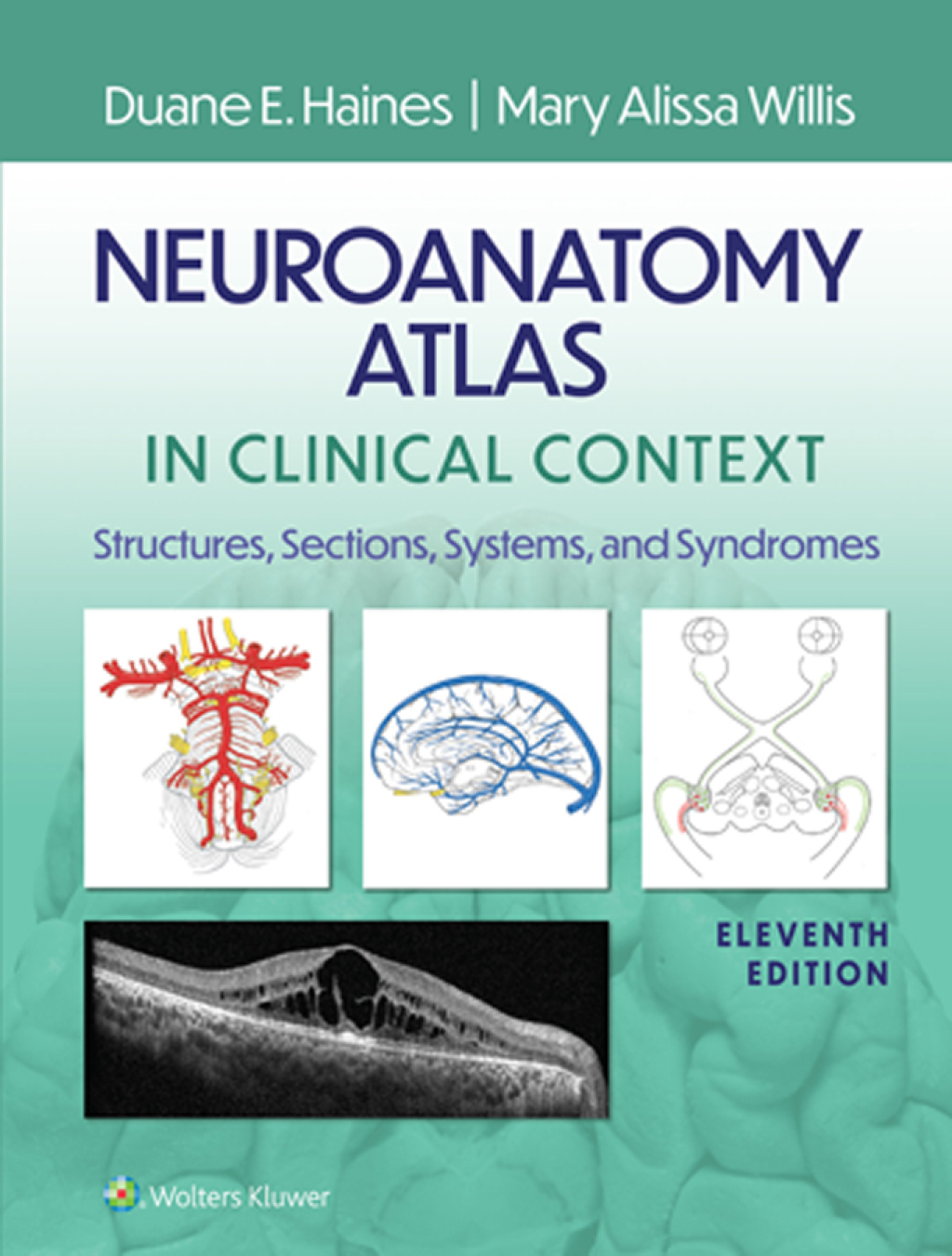Neuroanatomy Atlas in Clinical Context Structures, Sections, Systems, and Syndromes 11th Edition â€“ PDF/EPUB Version Downloadable