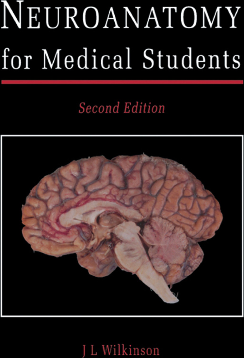 Neuroanatomy for Medical Students 2nd Edition â€“ PDF/EPUB Version Downloadable