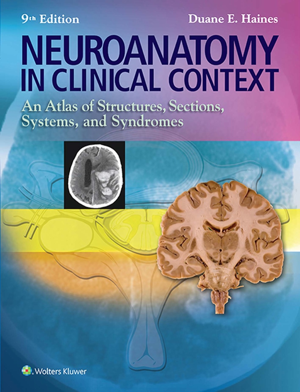Neuroanatomy in Clinical Context: An Atlas of Structures, Sections, Systems, and Syndromes 9th Edition â€“ PDF/EPUB Version Downloadable