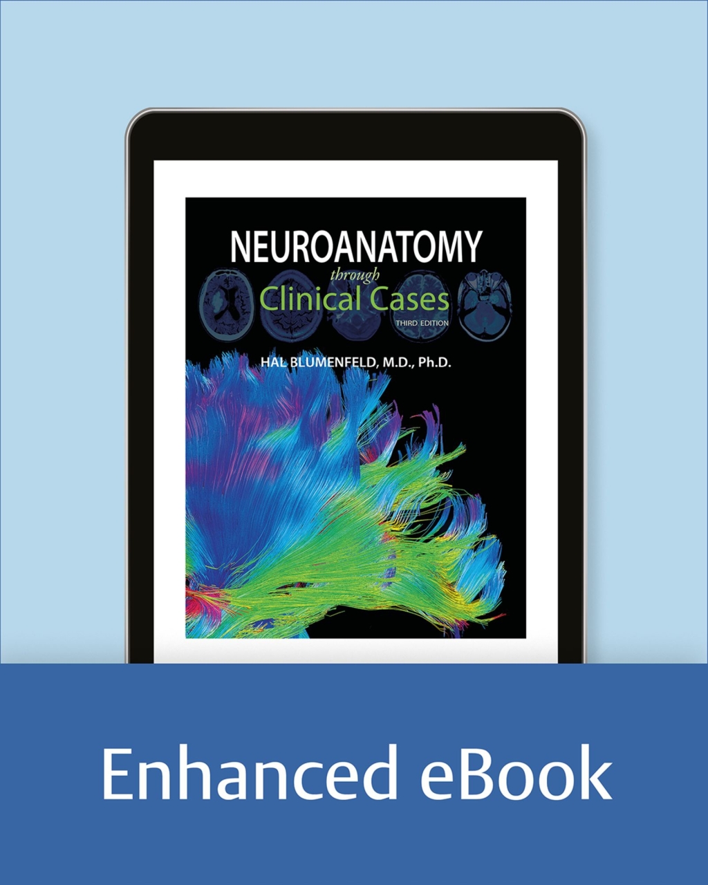 Neuroanatomy through Clinical Cases 3rd Edition â€“ PDF/EPUB Version Downloadable