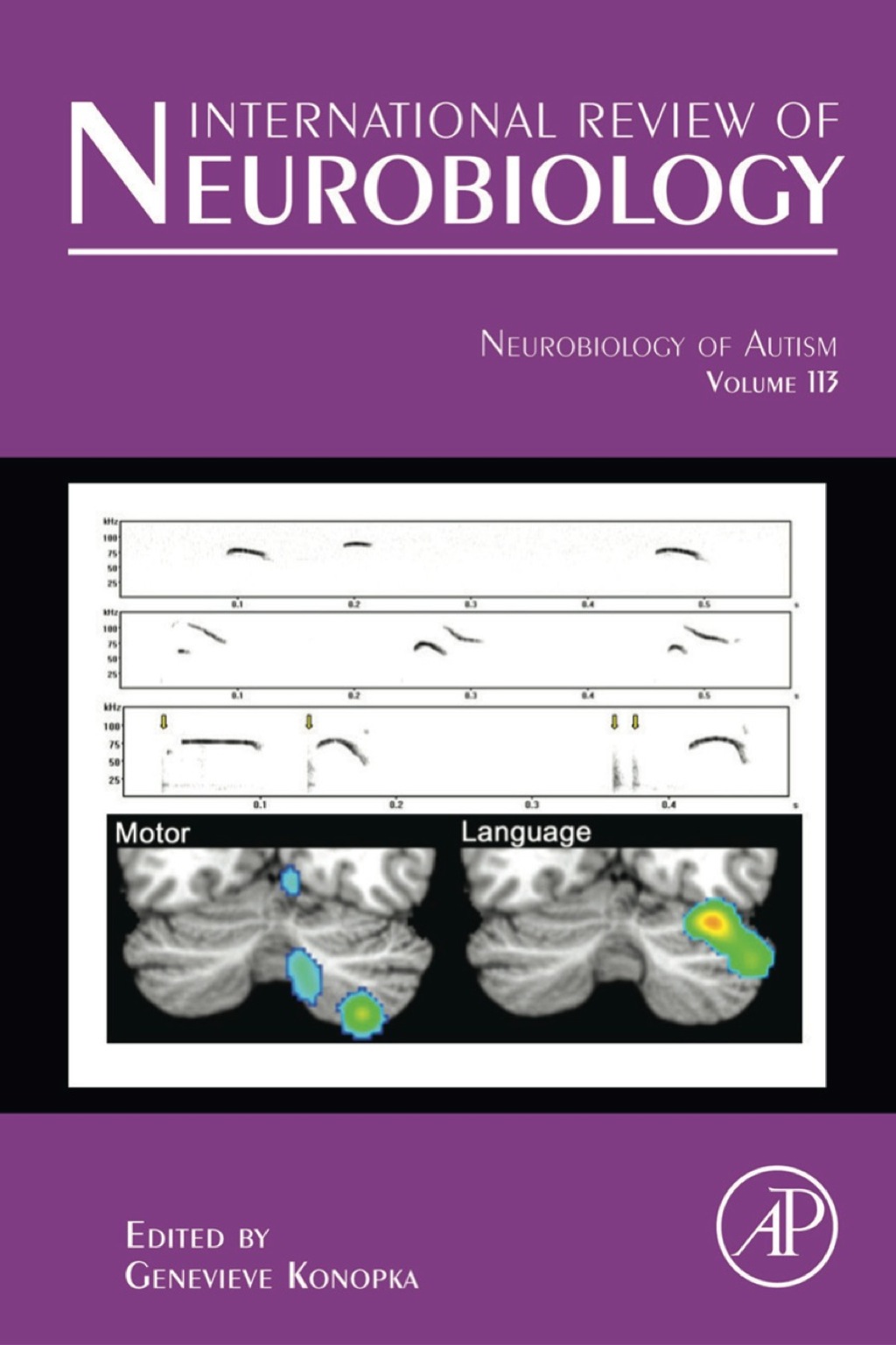 Neurobiology of Autism – PDF/EPUB Version Downloadable Neurobiology of Autism – PDF/EPUB Version Downloadable - Image 1