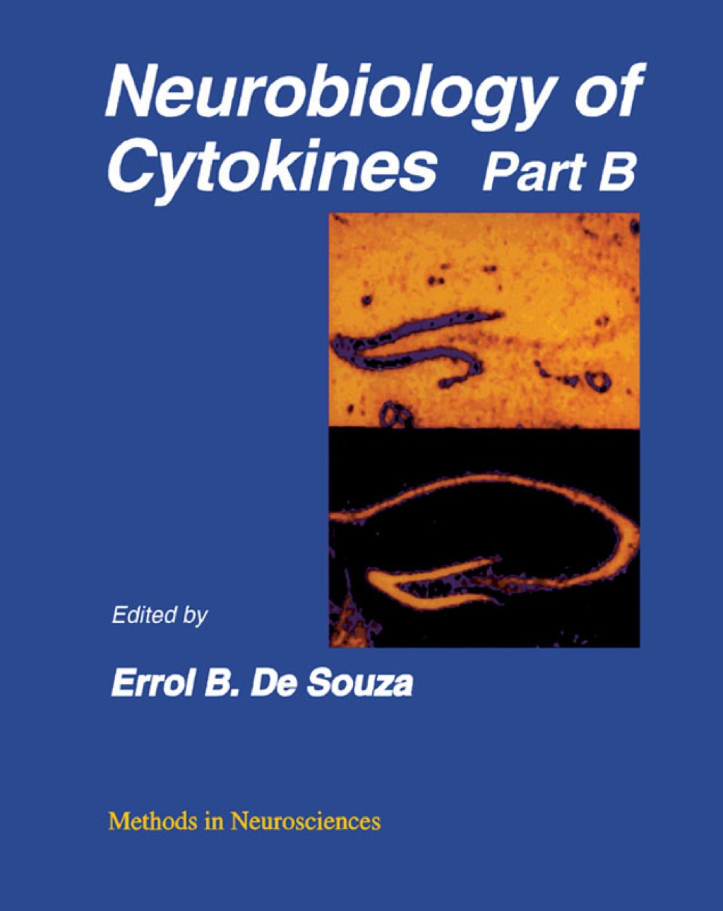 Neurobiology of Cytokines: Volume 17: Neurobiology of Cytokines Part B  â€“ PDF/EPUB Version Downloadable