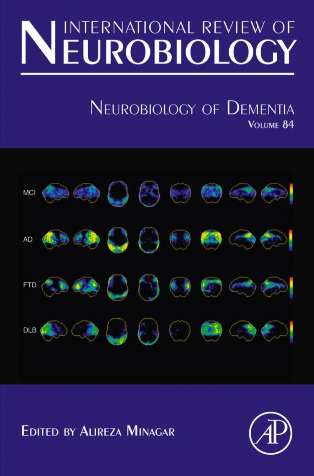 Neurobiology of Dementia – PDF/EPUB Version Downloadable Neurobiology of Dementia – PDF/EPUB Version Downloadable - Image 1