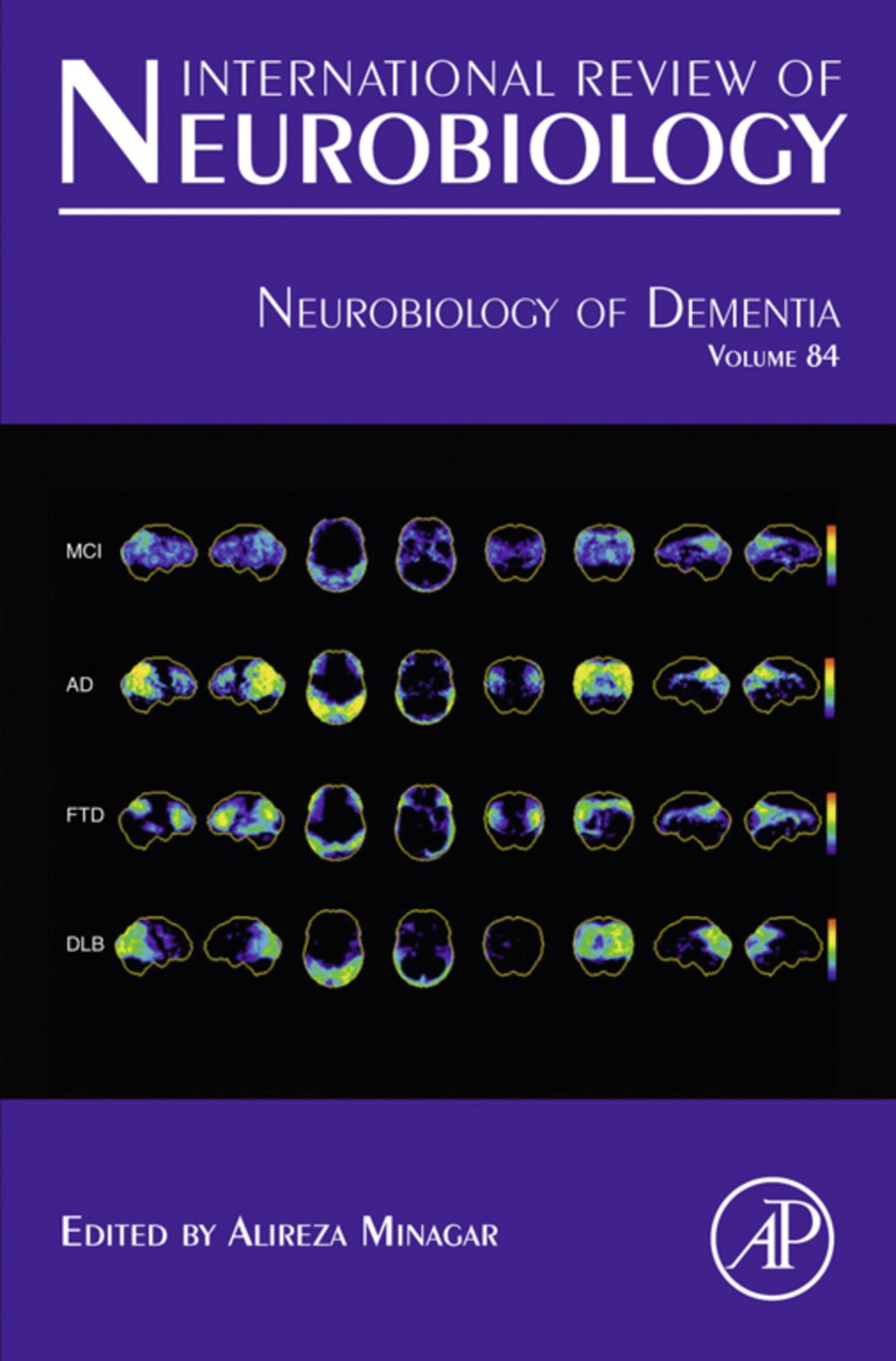 Neurobiology of Dementia  â€“ PDF/EPUB Version Downloadable