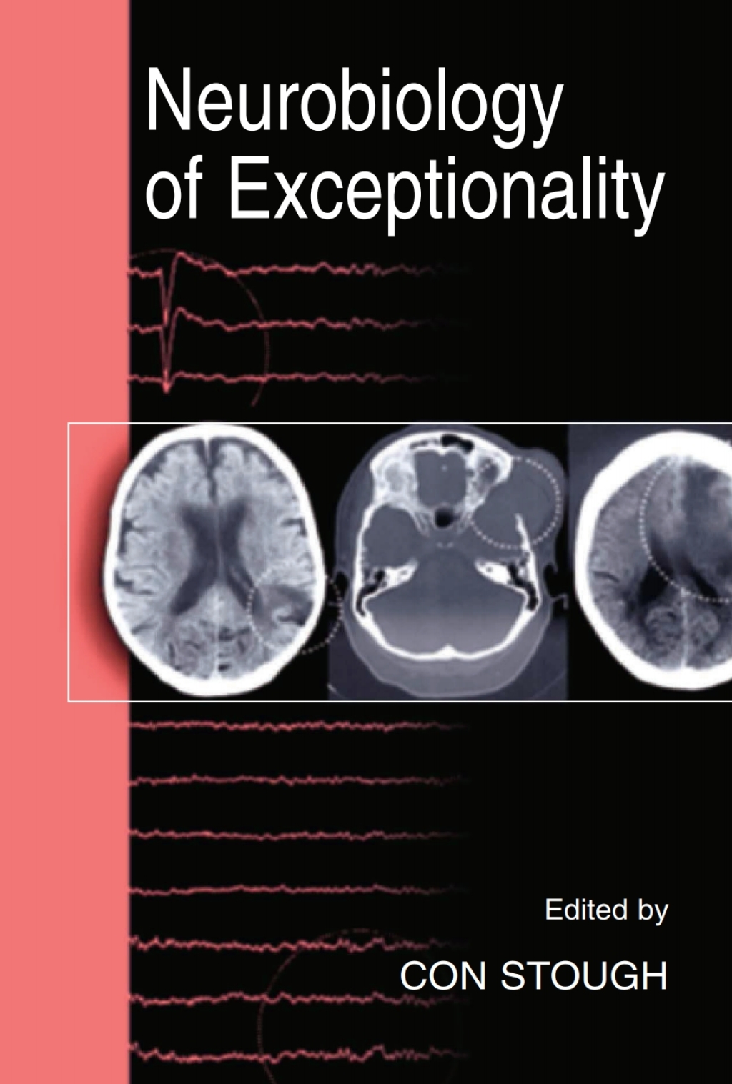 Neurobiology of Exceptionality 1st Edition â€“ PDF/EPUB Version Downloadable