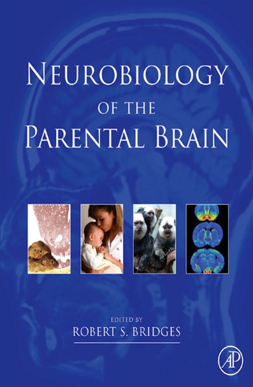 Neurobiology of the Parental Brain  â€“ PDF/EPUB Version Downloadable