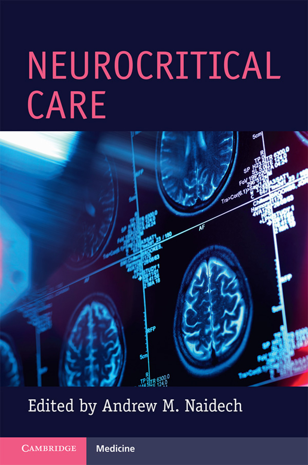 Neurocritical Care  â€“ PDF/EPUB Version Downloadable