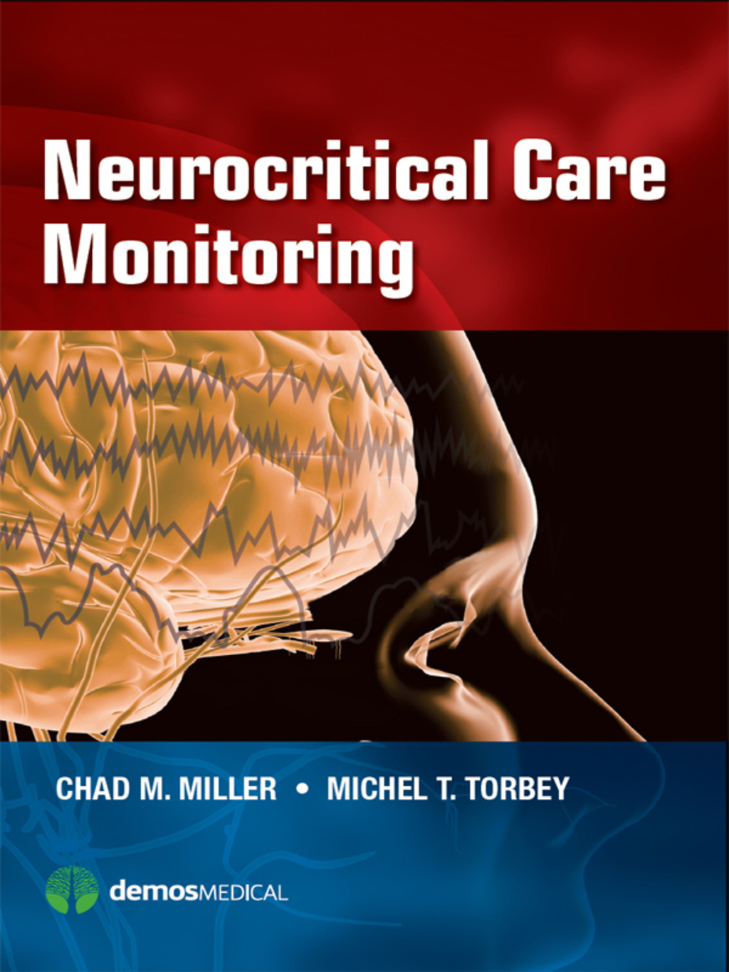 Neurocritical Care Monitoring 1st Edition â€“ PDF/EPUB Version Downloadable