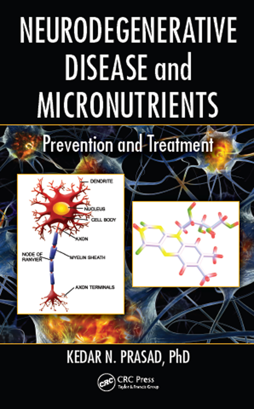 Neurodegenerative Disease and Micronutrients Prevention and Treatment 1st Edition â€“ PDF/EPUB Version Downloadable