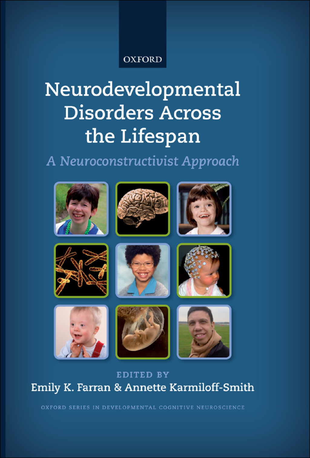 Neurodevelopmental Disorders Across the Lifespan A neuroconstructivist approach 1st Edition â€“ PDF/EPUB Version Downloadable