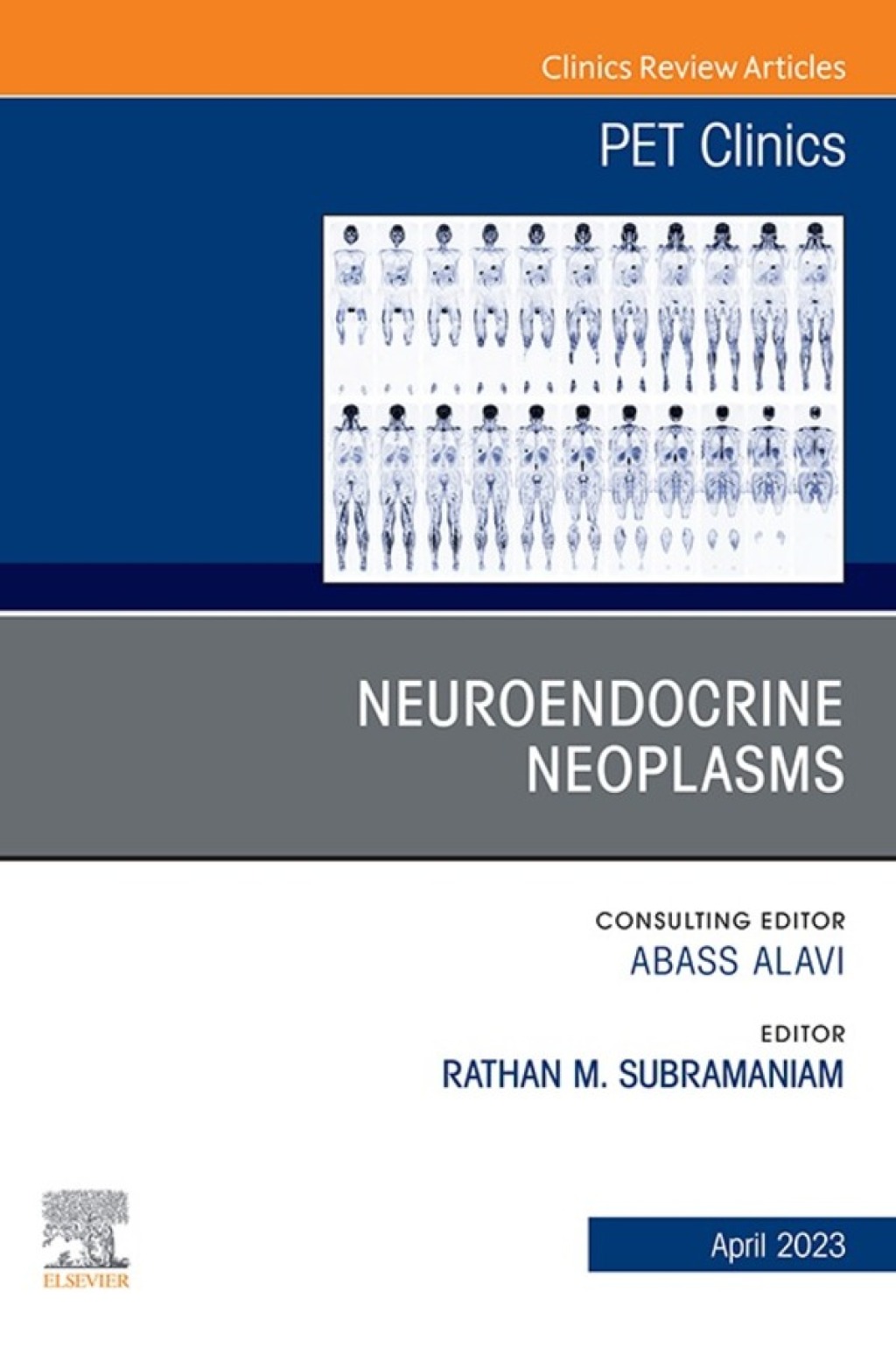 Neuroendocrine Neoplasms, An Issue of PET Clinics 1st Edition â€“ PDF/EPUB Version Downloadable