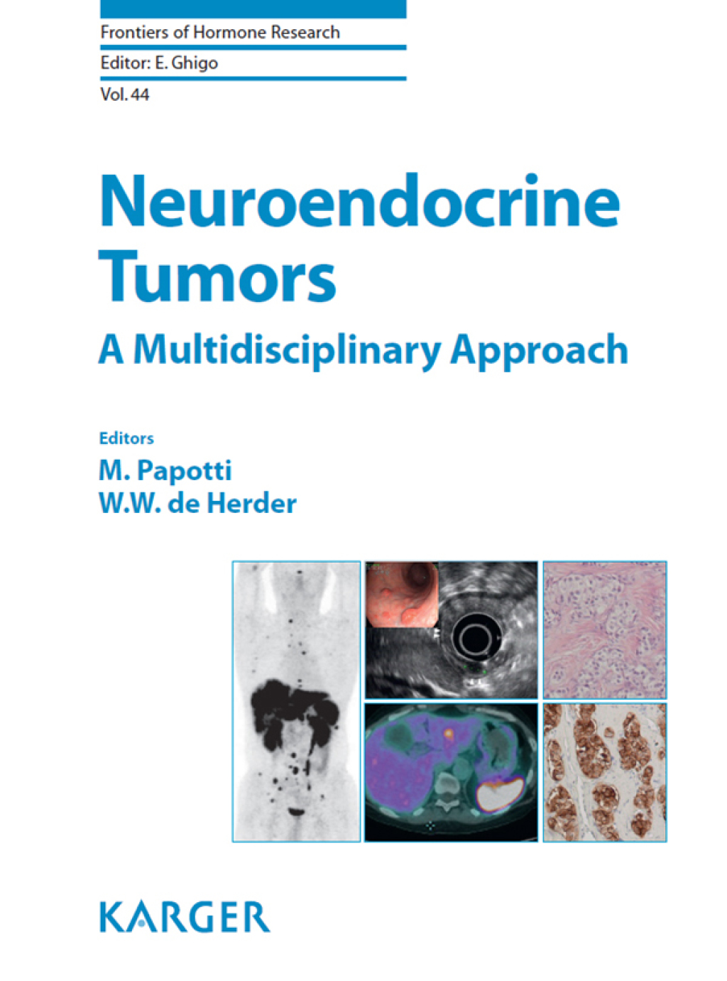 Neuroendocrine Tumors: A Multidisciplinary Approach 1st Edition â€“ PDF/EPUB Version Downloadable