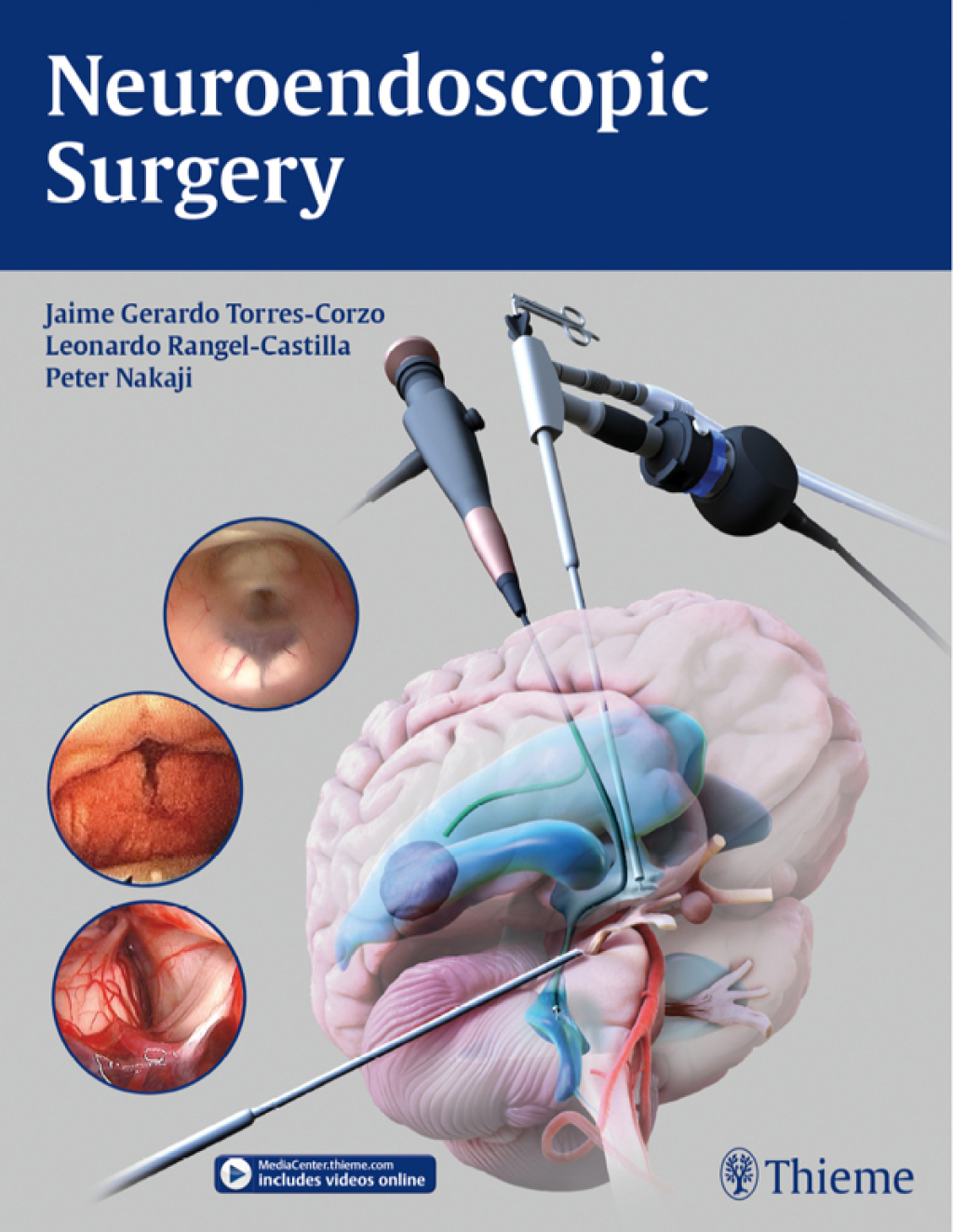 Neuroendoscopic Surgery 1st Edition â€“ PDF/EPUB Version Downloadable