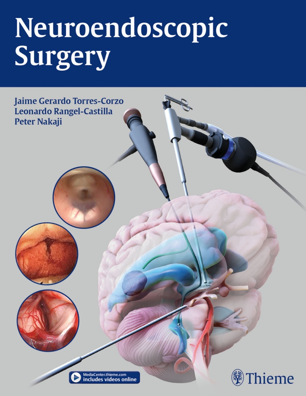 Neuroendoscopic Surgery 1st Edition â€“ PDF/EPUB Version Downloadable