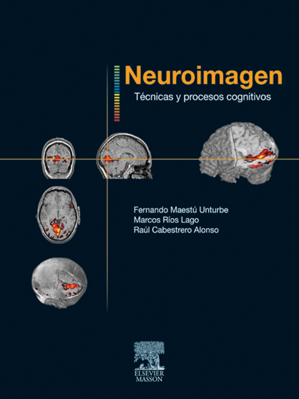 Neuroimagen. TÃ©cnicas y procesos cognitivos  â€“ PDF/EPUB Version Downloadable
