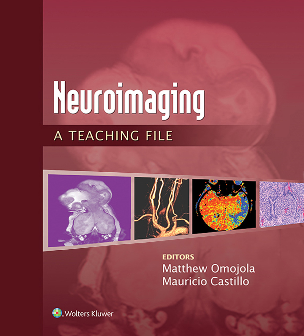 Neuroimaging: A Teaching File A Teaching File  â€“ PDF/EPUB Version Downloadable