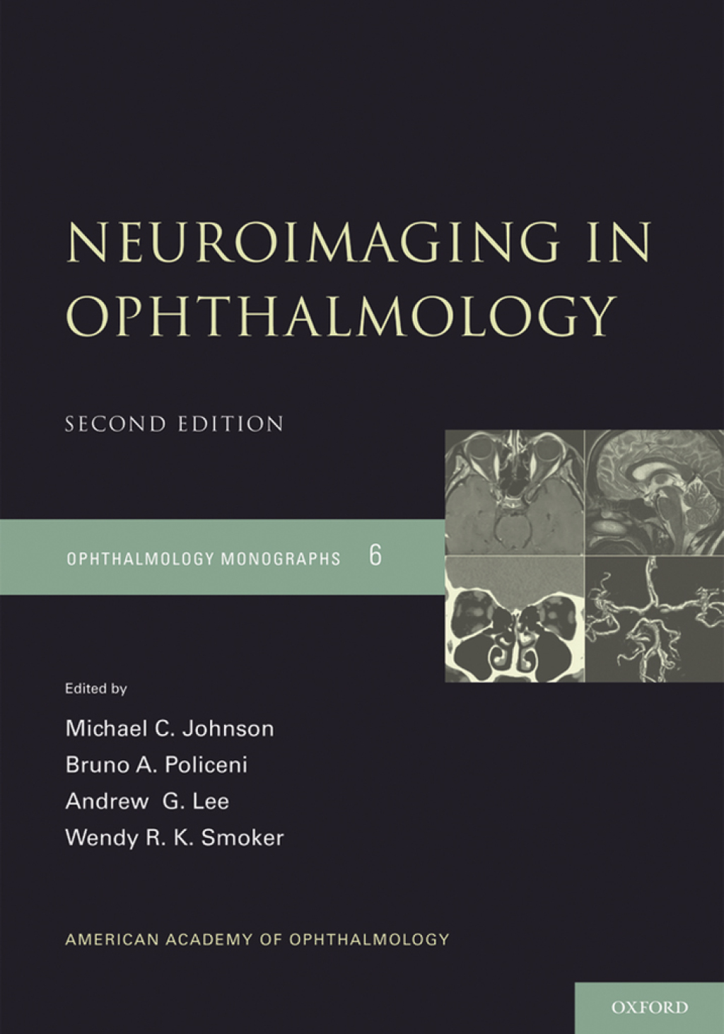 Neuroimaging in Ophthalmology 2nd Edition â€“ PDF/EPUB Version Downloadable