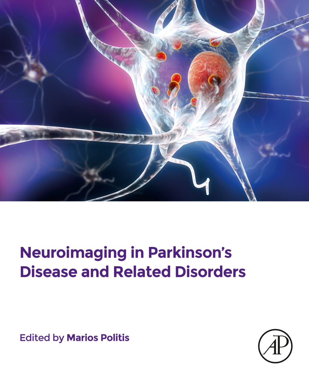 Neuroimaging in Parkinsonâ€™s Disease and Related Disorders 1st Edition â€“ PDF/EPUB Version Downloadable