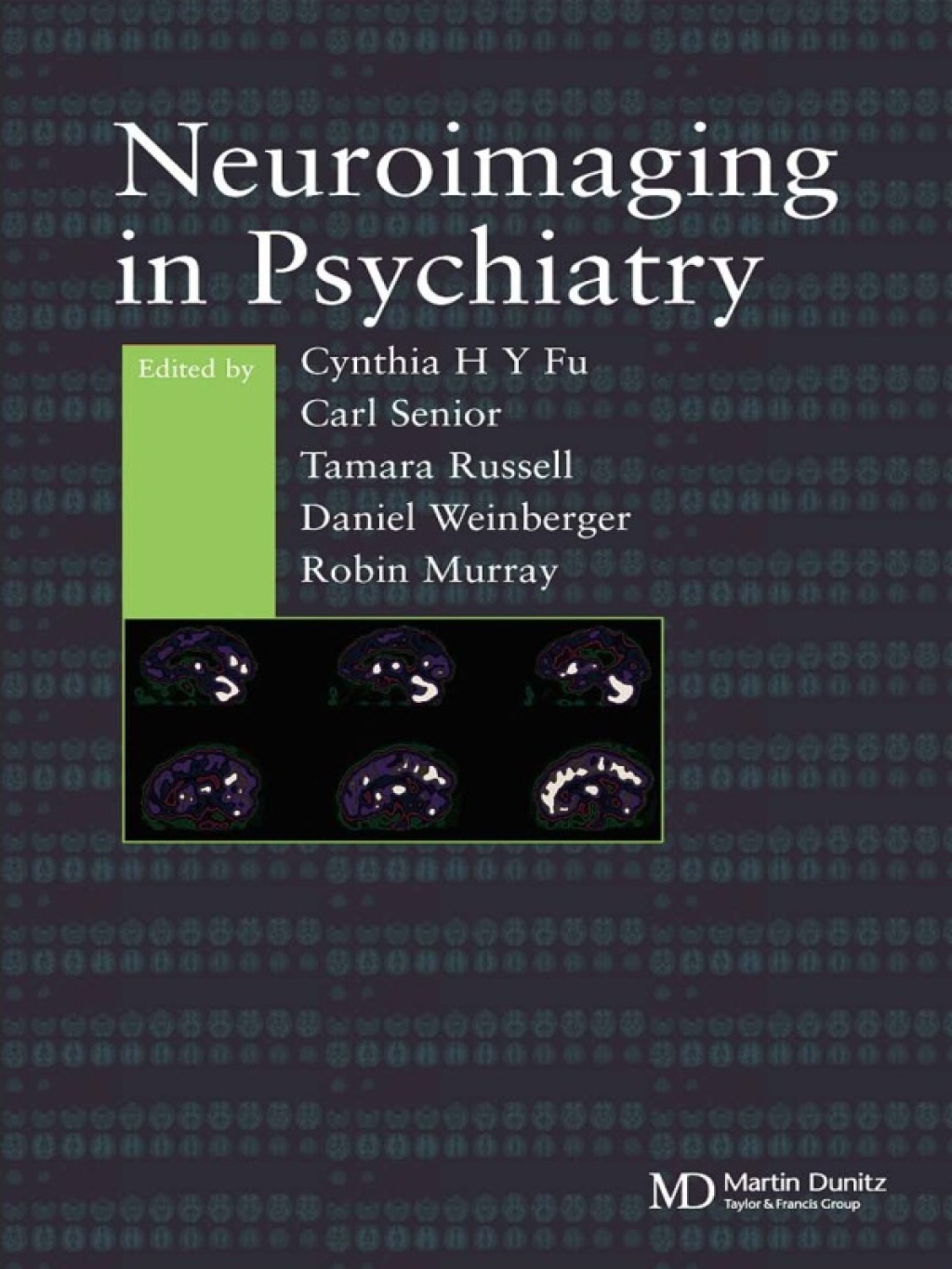 Neuroimaging in Psychiatry 1st Edition â€“ PDF/EPUB Version Downloadable
