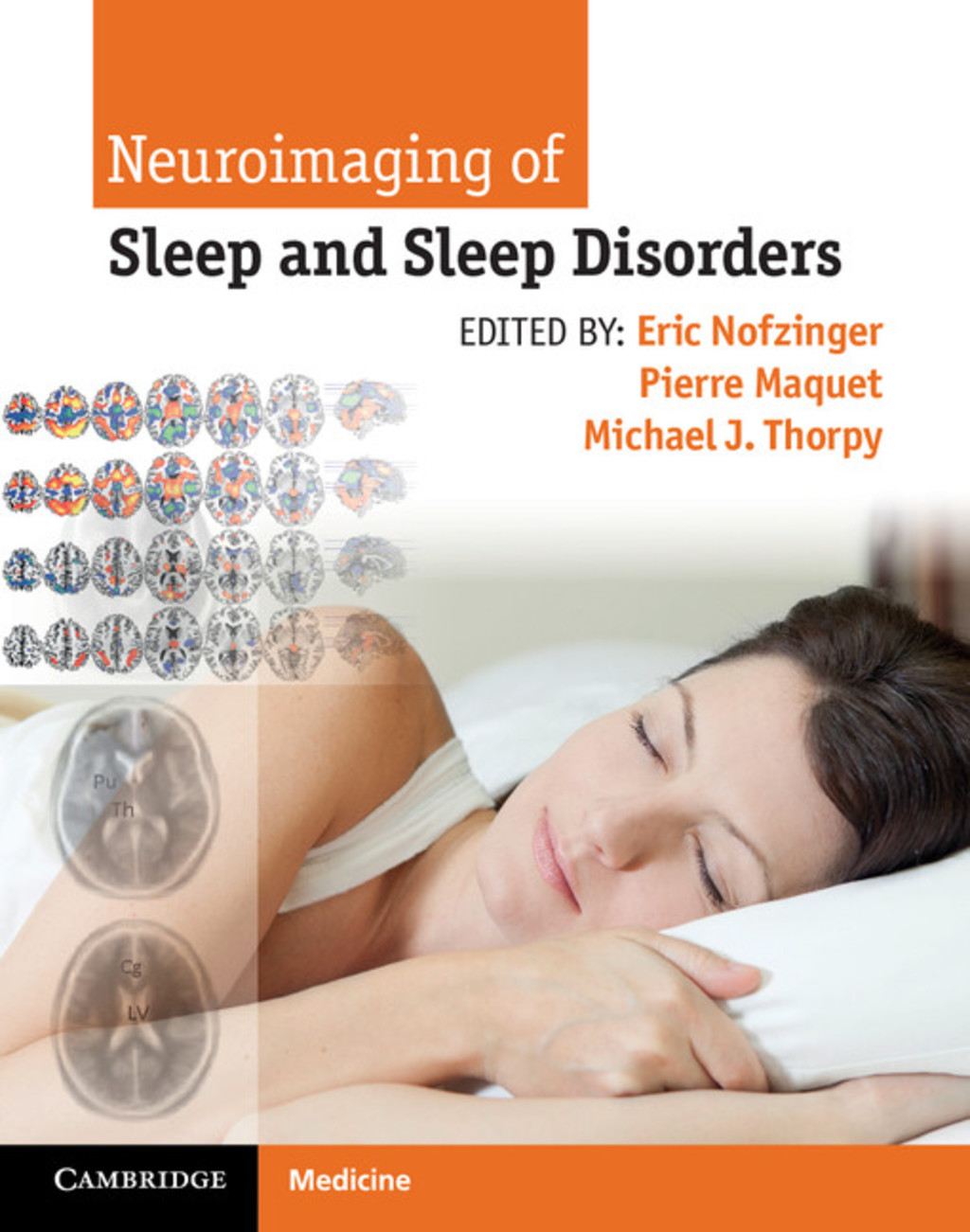 Neuroimaging of Sleep and Sleep Disorders 1st Edition â€“ PDF/EPUB Version Downloadable