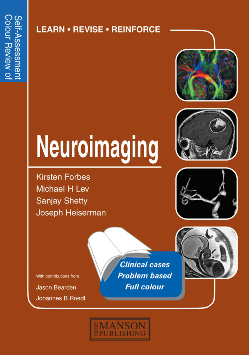 Neuroimaging Self-Assessment Colour Review 1st Edition â€“ PDF/EPUB Version Downloadable