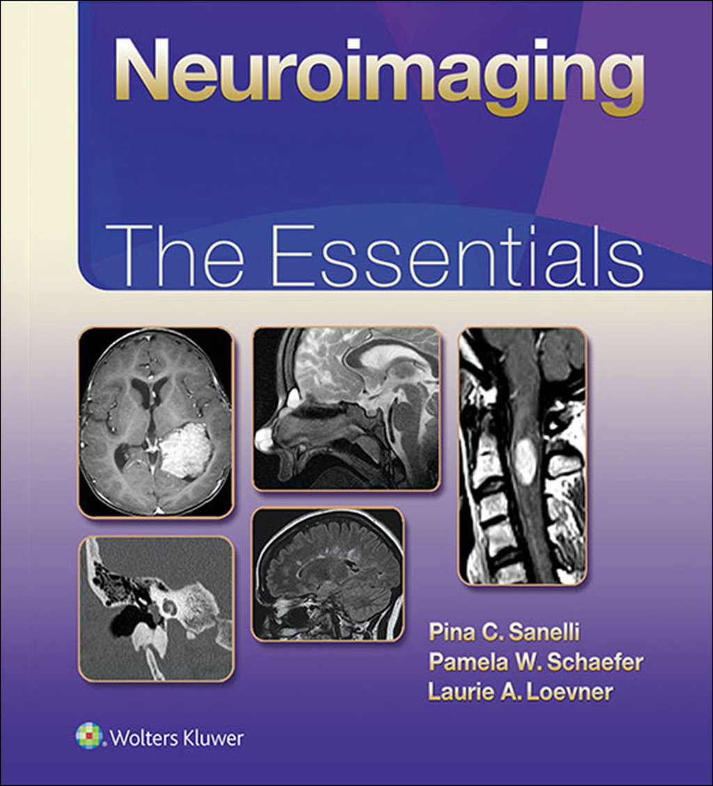 Neuroimaging: The Essentials  â€“ PDF/EPUB Version Downloadable