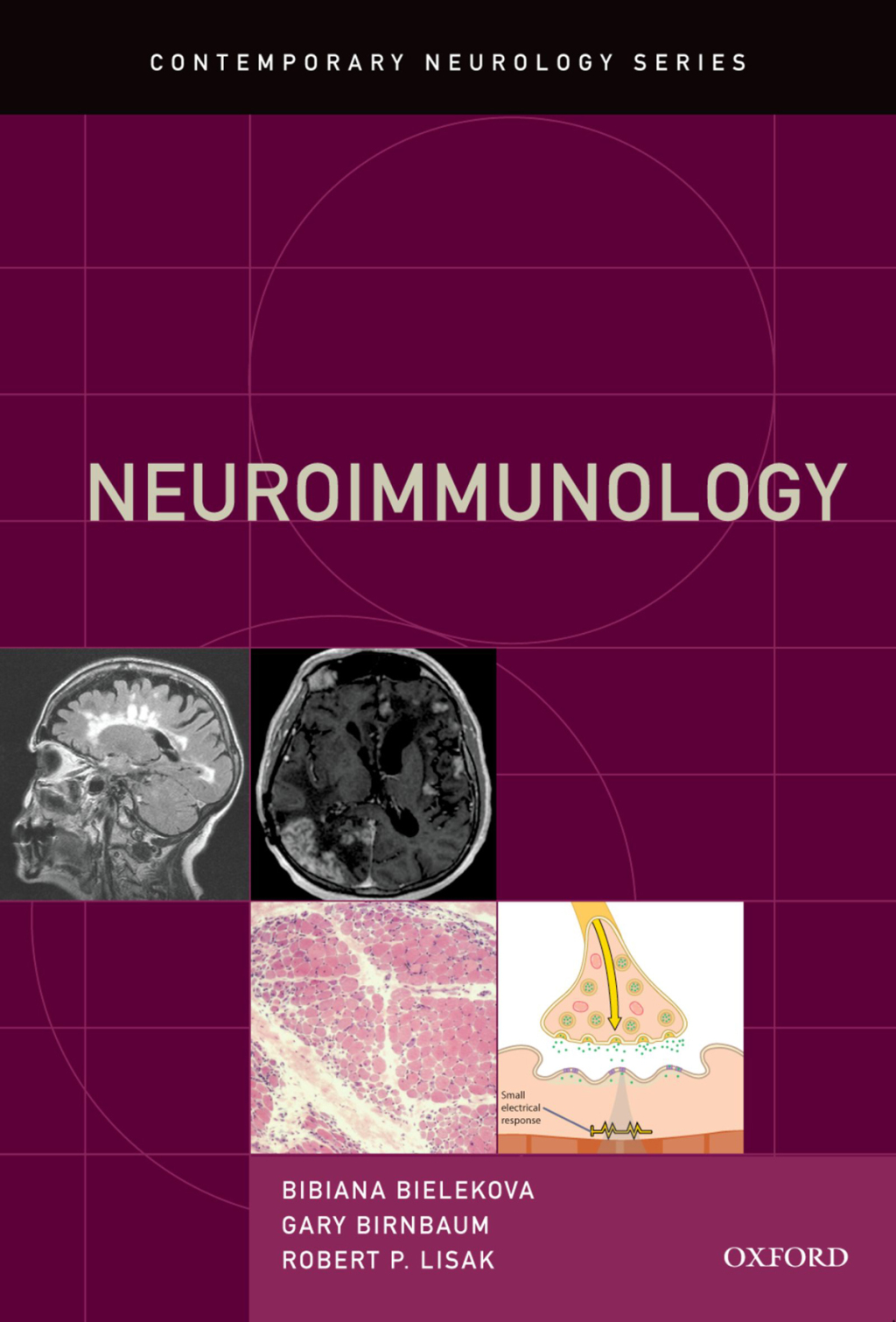 Neuroimmunology 1st Edition â€“ PDF/EPUB Version Downloadable